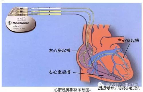 胃开启了连轴转模式