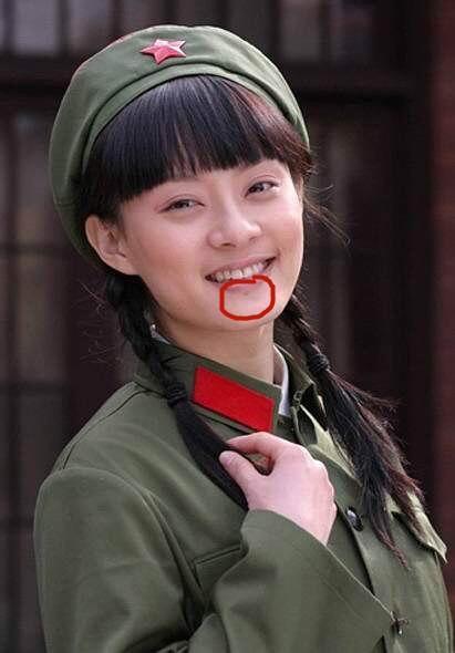 孙俪唇下痣没了